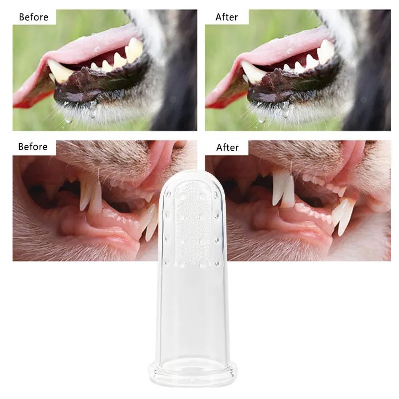 MessFree® Finger Toothbrush